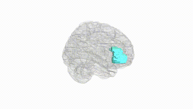 Full Brain White