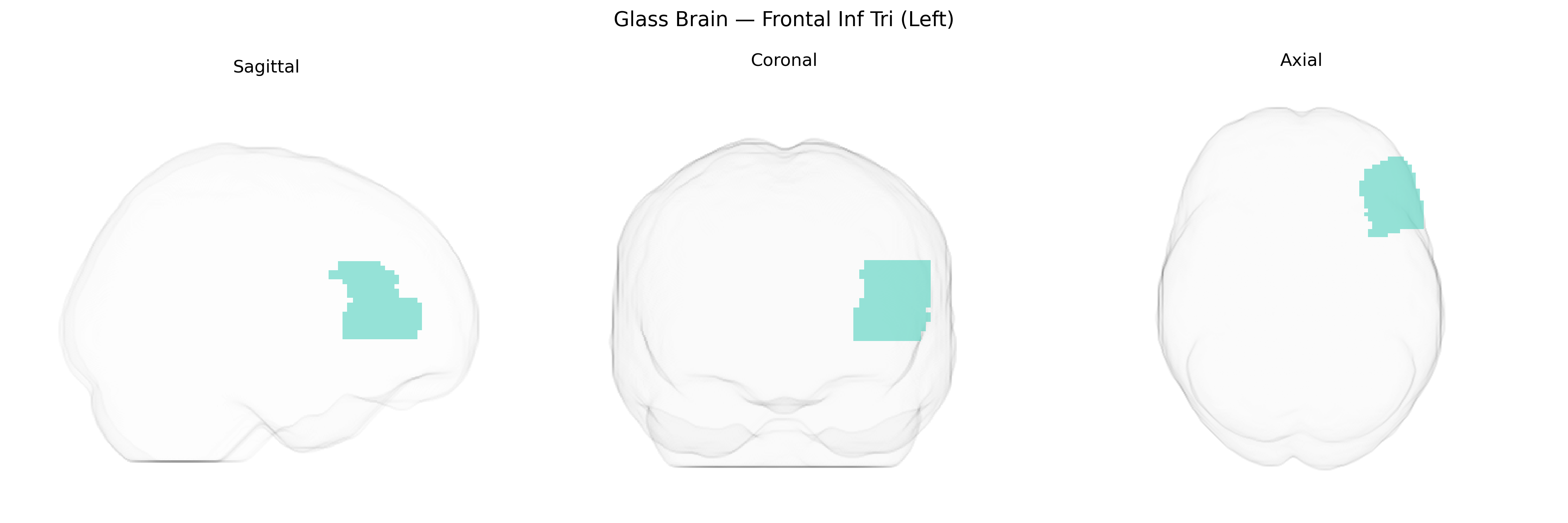Triplanar Ghost Brain