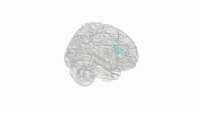Full Brain White