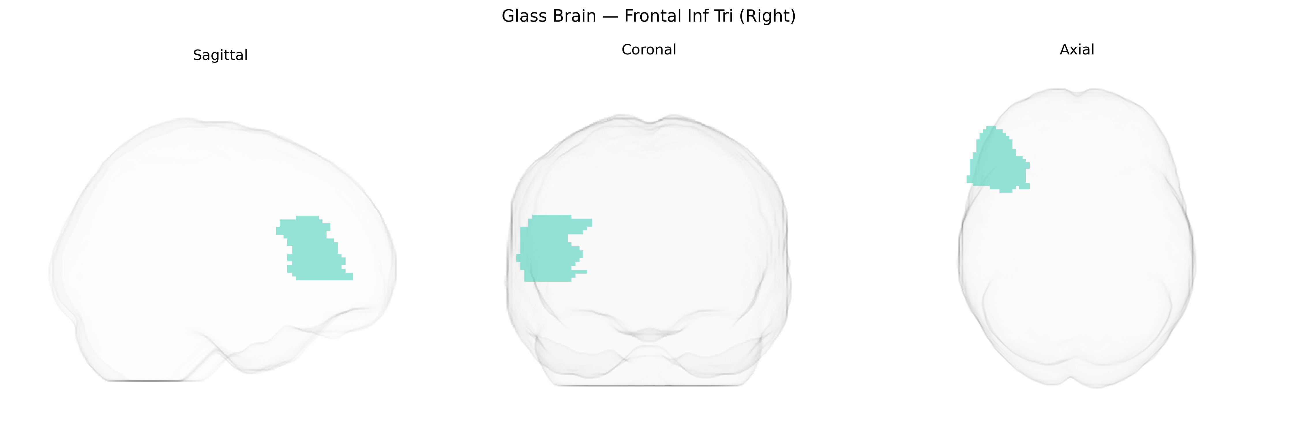 Triplanar Ghost Brain