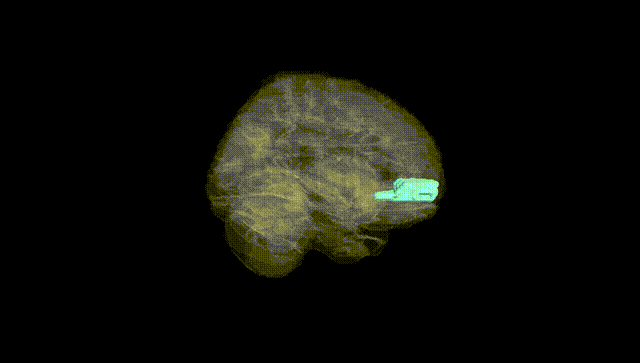 Full Brain Black