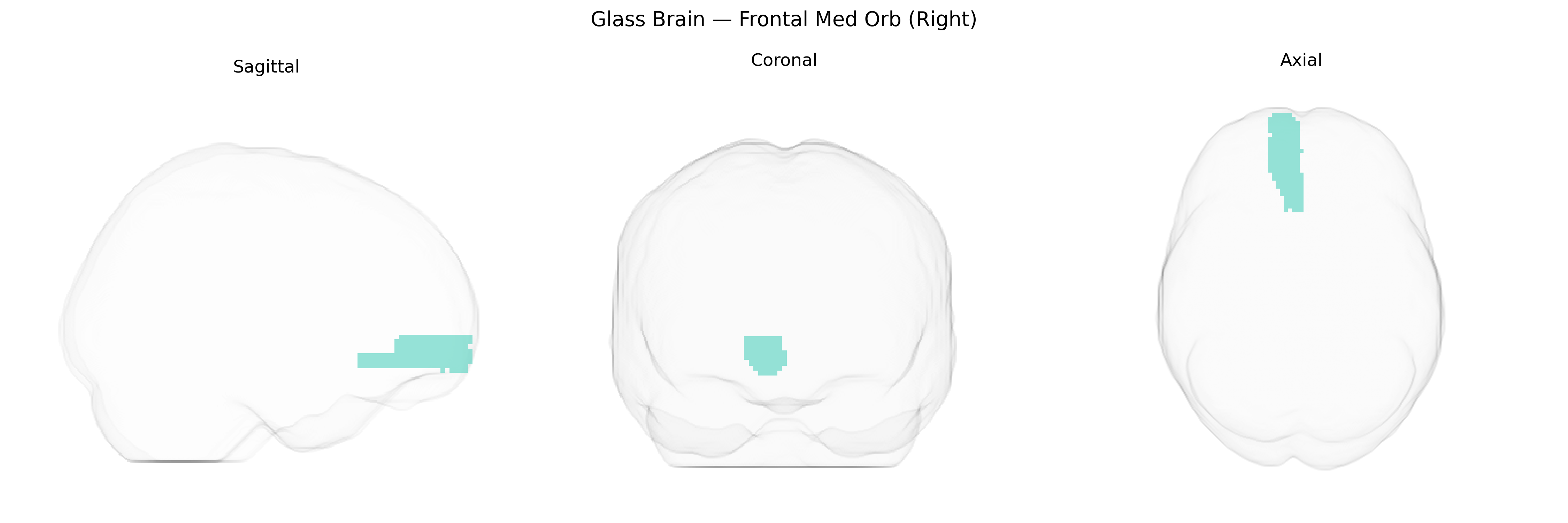 Triplanar Ghost Brain
