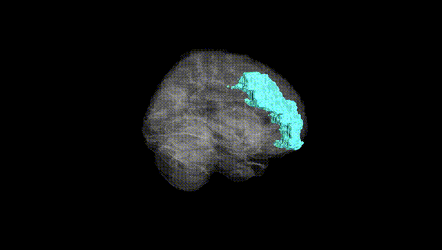 Full Brain Black