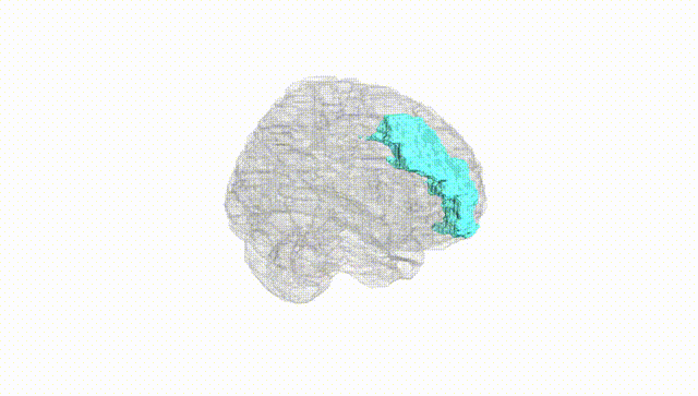 Full Brain White