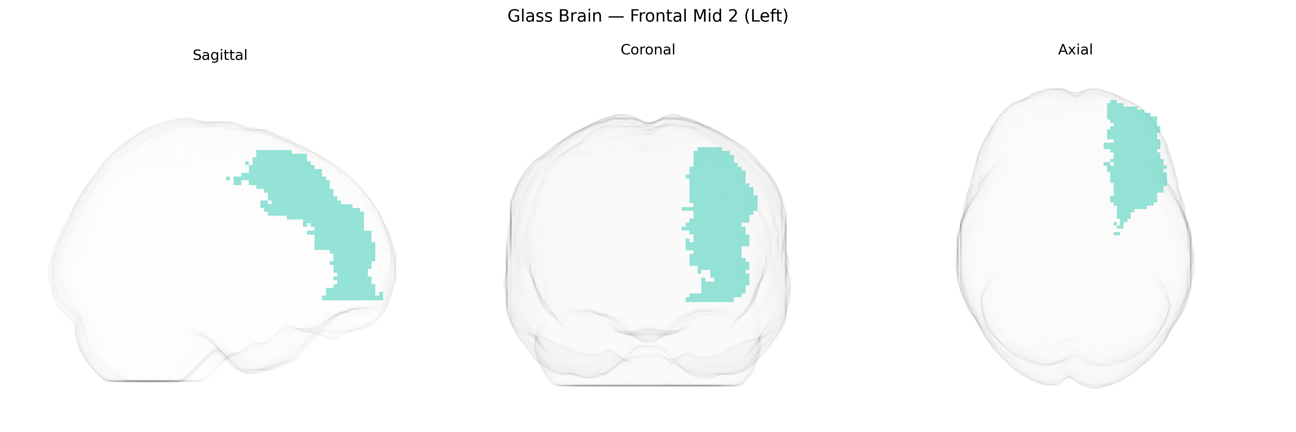 Triplanar Ghost Brain
