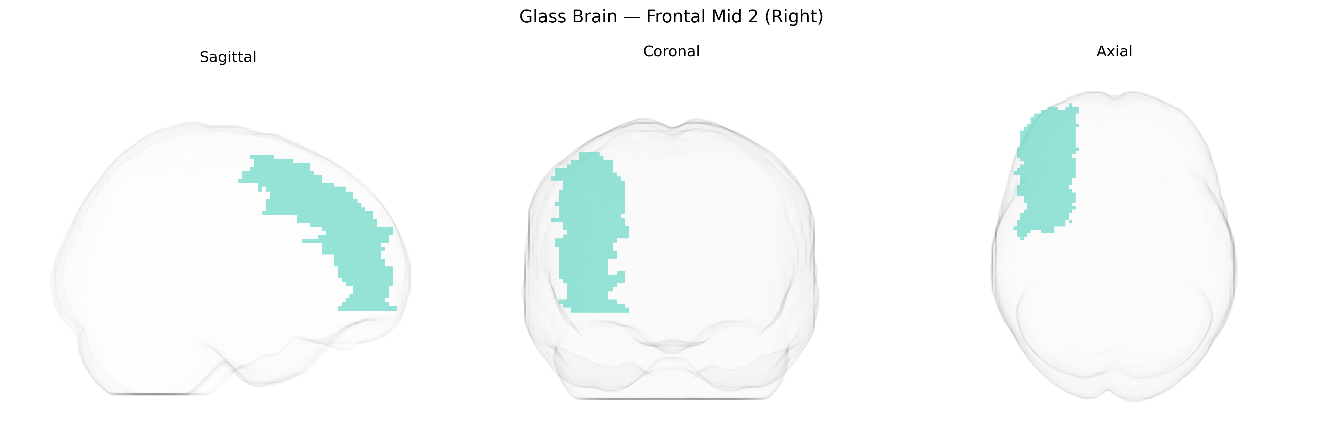 Triplanar Ghost Brain