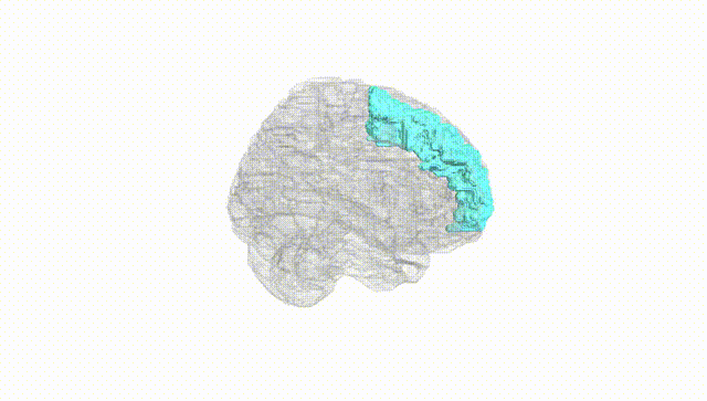 Full Brain White