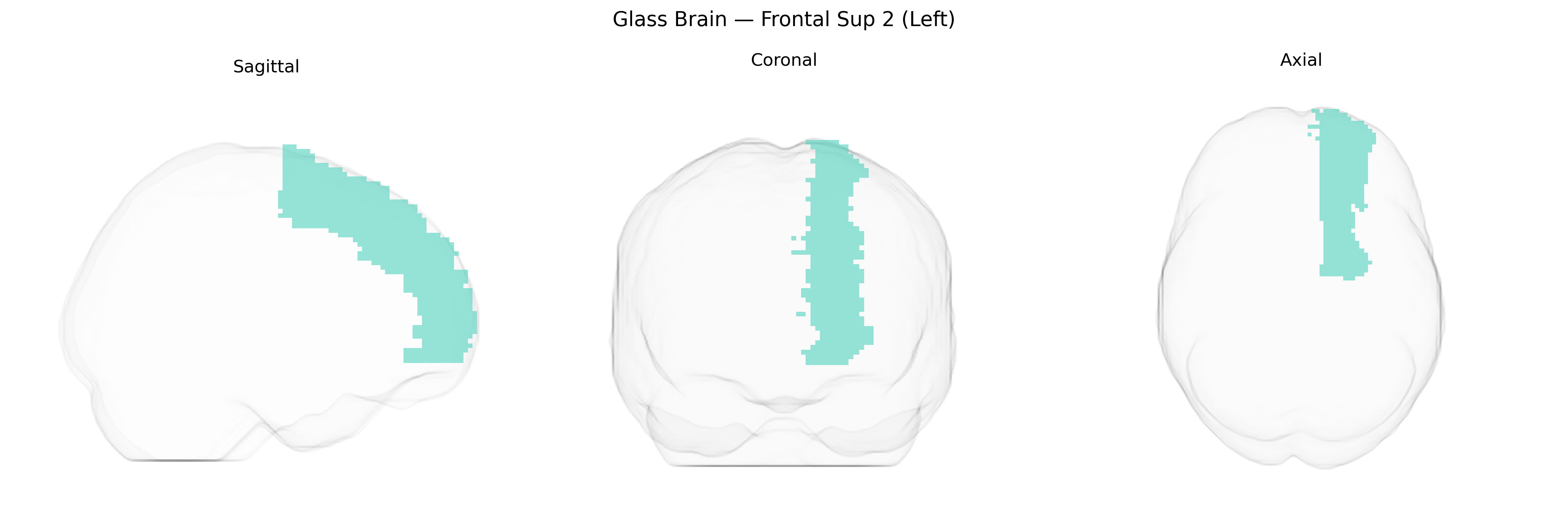 Triplanar Ghost Brain