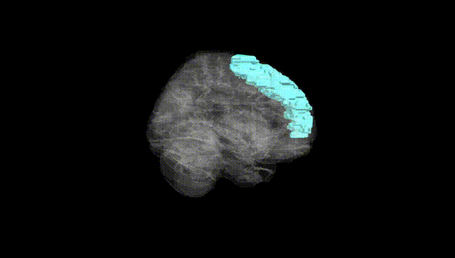 Full Brain Black