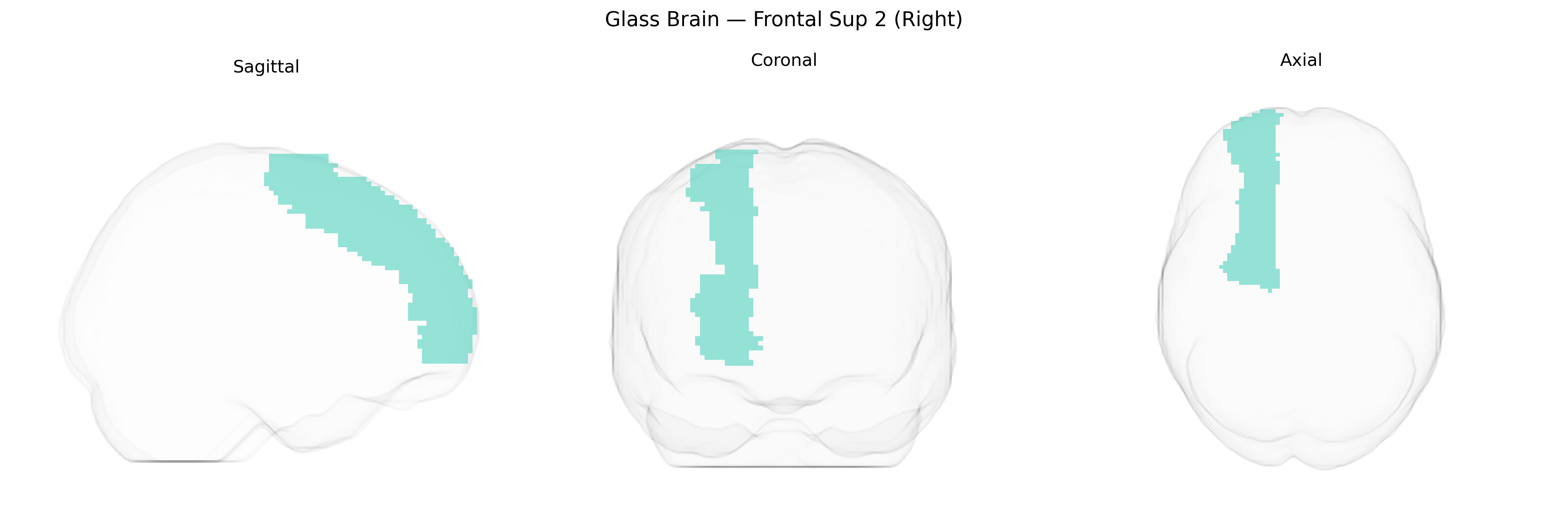 Triplanar Ghost Brain