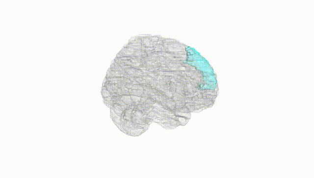 Full Brain White