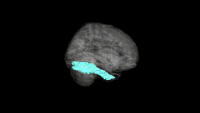 Full Brain Black