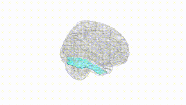 Full Brain White