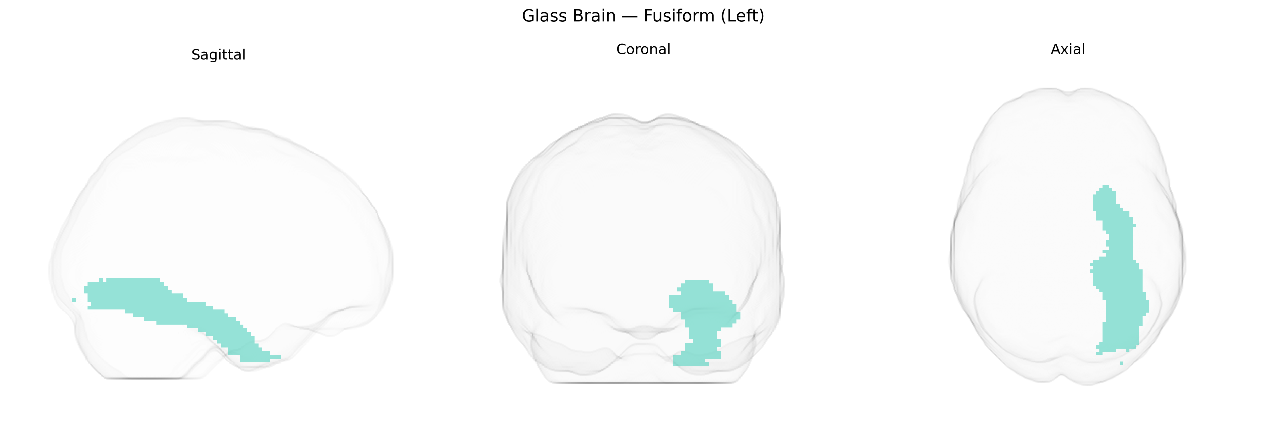 Triplanar Ghost Brain