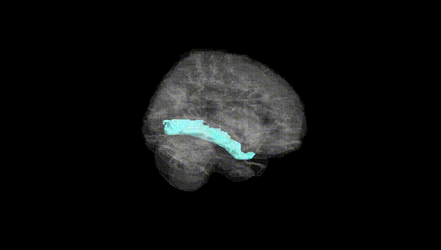 Full Brain Black