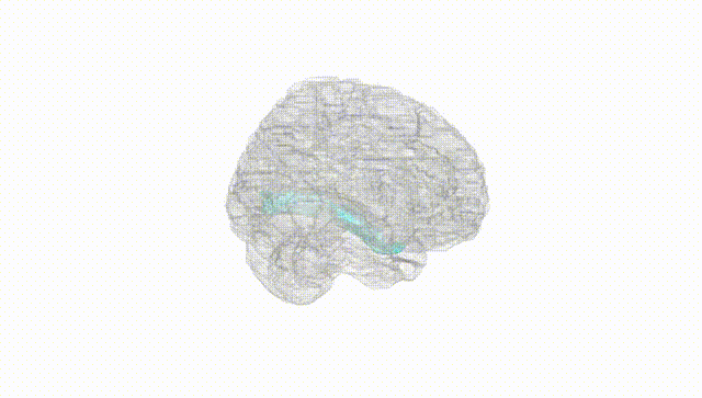Full Brain White