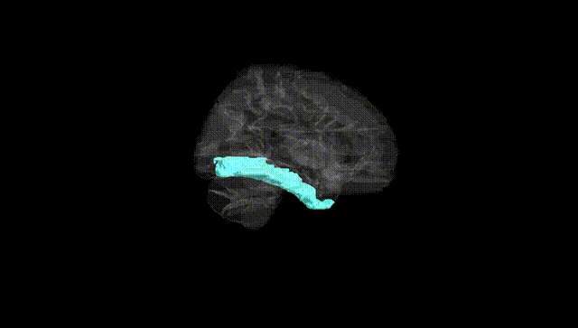 Hemisphere Black