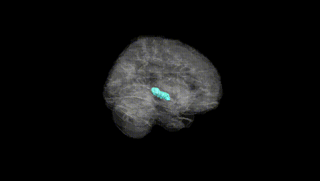Full Brain Black