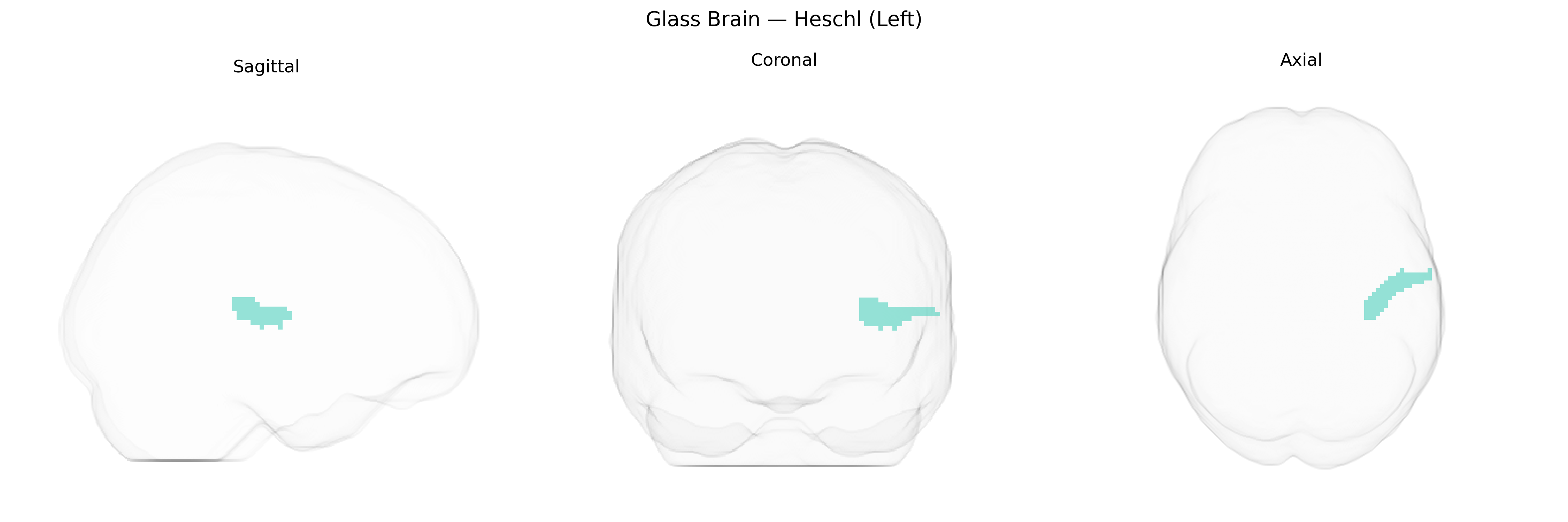 Triplanar Ghost Brain