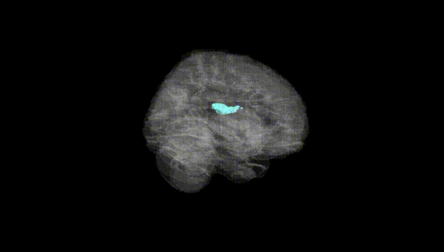 Full Brain Black