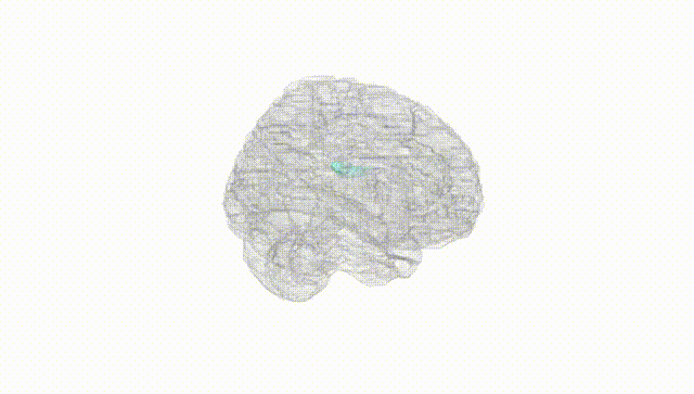 Full Brain White
