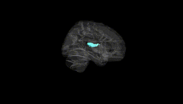 Hemisphere Black