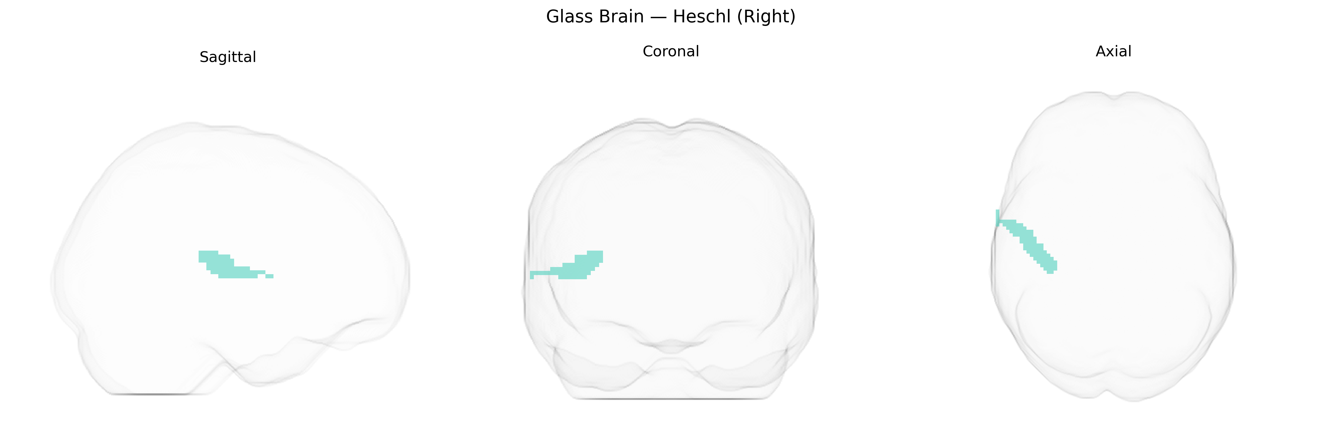 Triplanar Ghost Brain