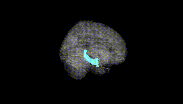 Full Brain Black