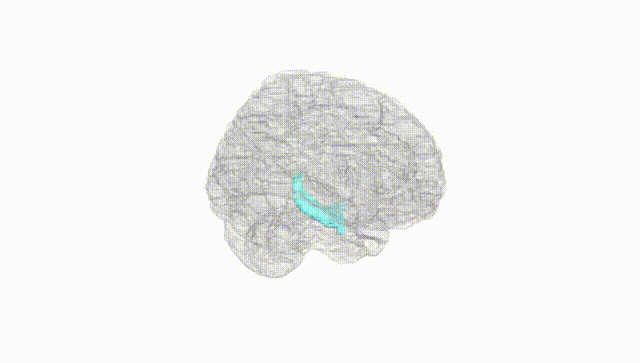 Full Brain White