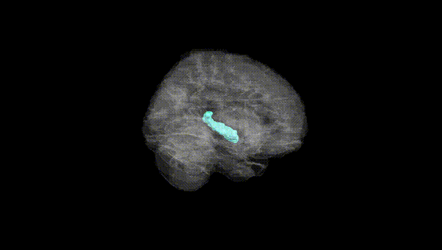 Full Brain Black