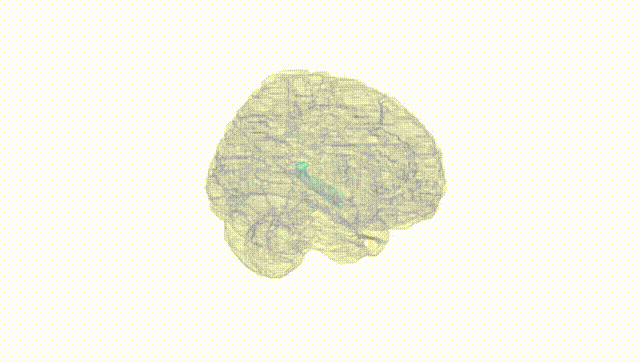 Full Brain White