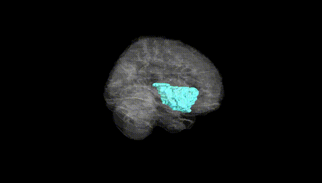 Full Brain Black