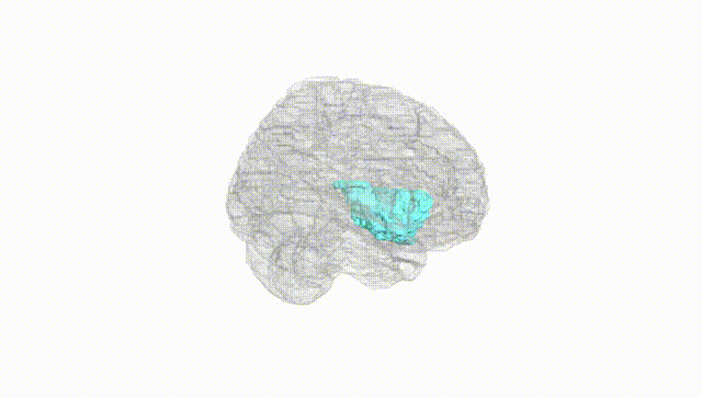Full Brain White