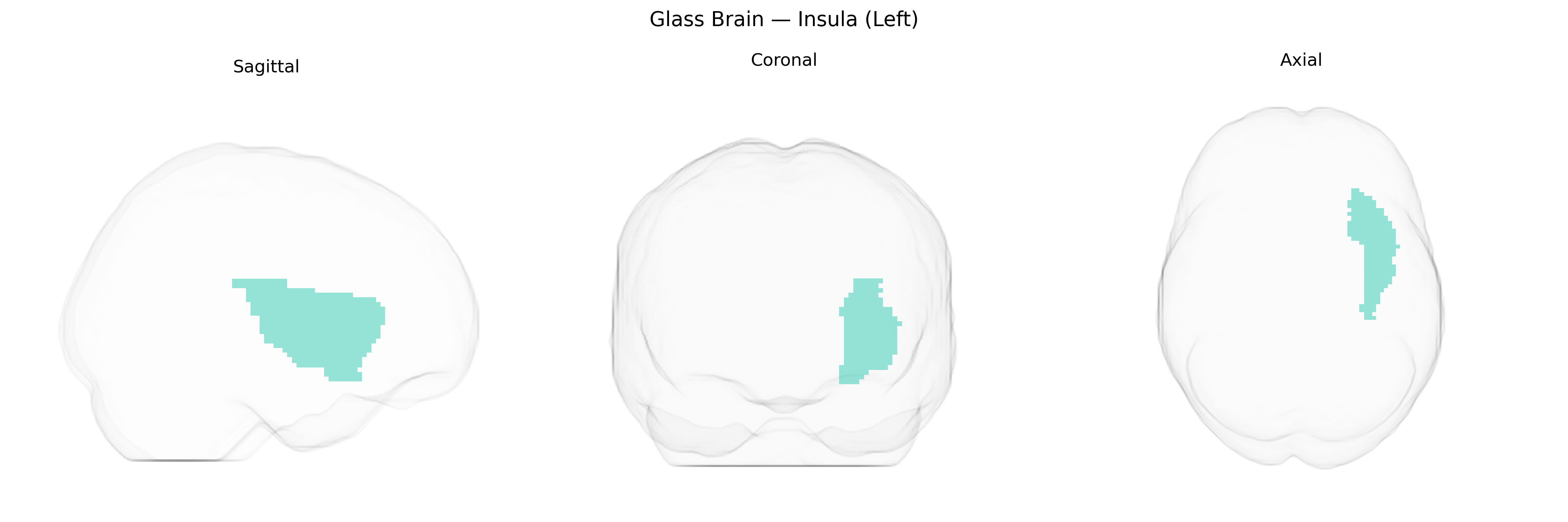 Triplanar Ghost Brain