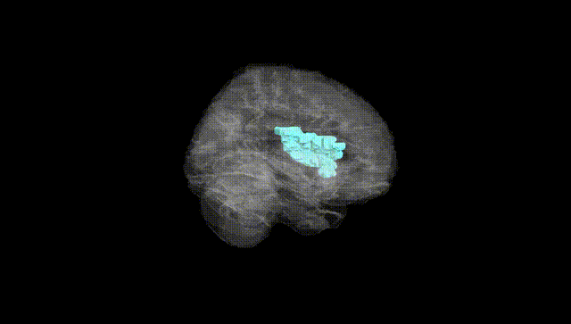 Full Brain Black