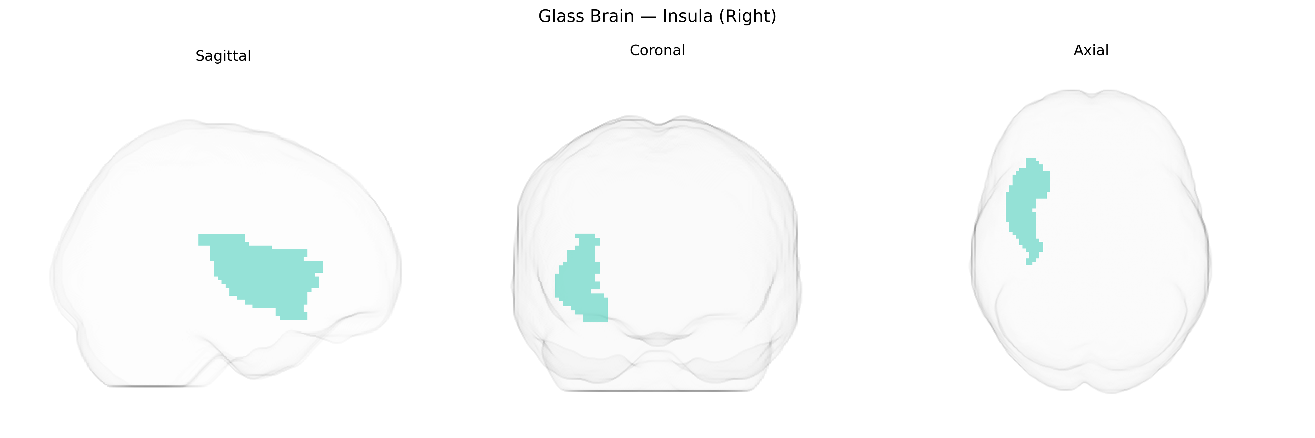 Triplanar Ghost Brain