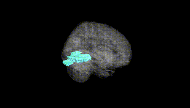 Full Brain Black