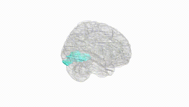 Full Brain White