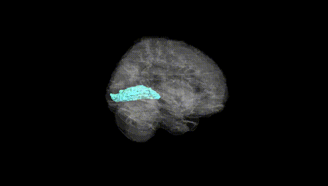Full Brain Black