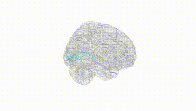 Full Brain White