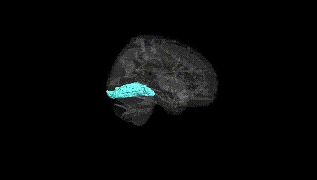 Hemisphere Black
