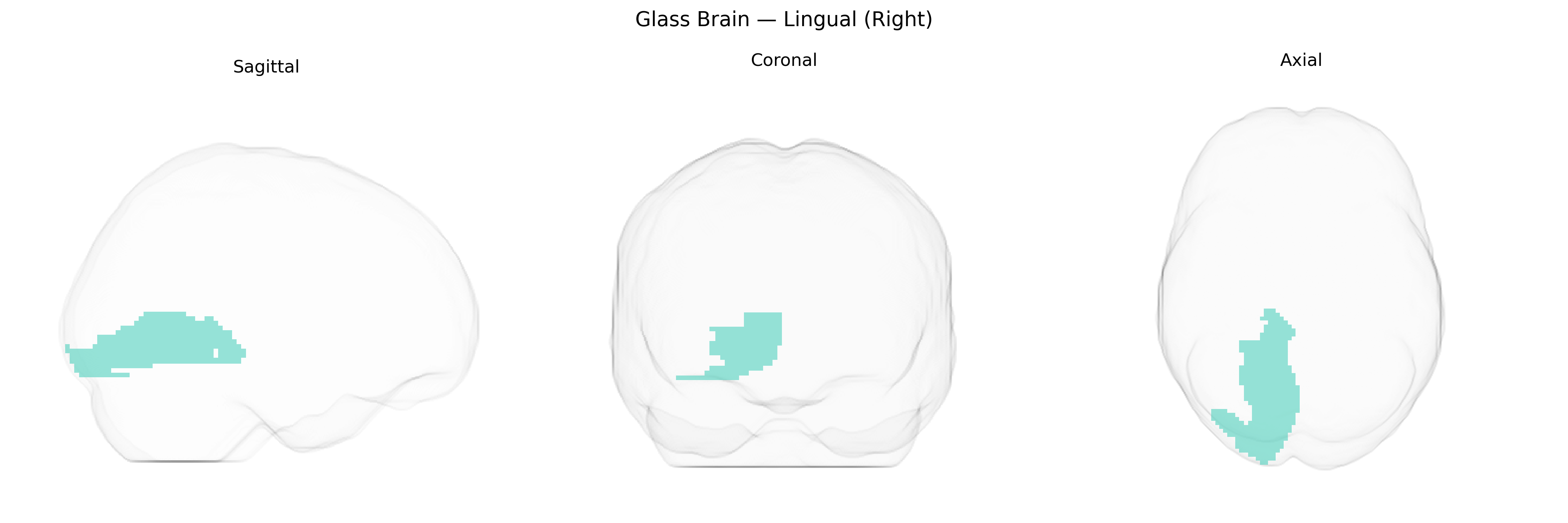 Triplanar Ghost Brain