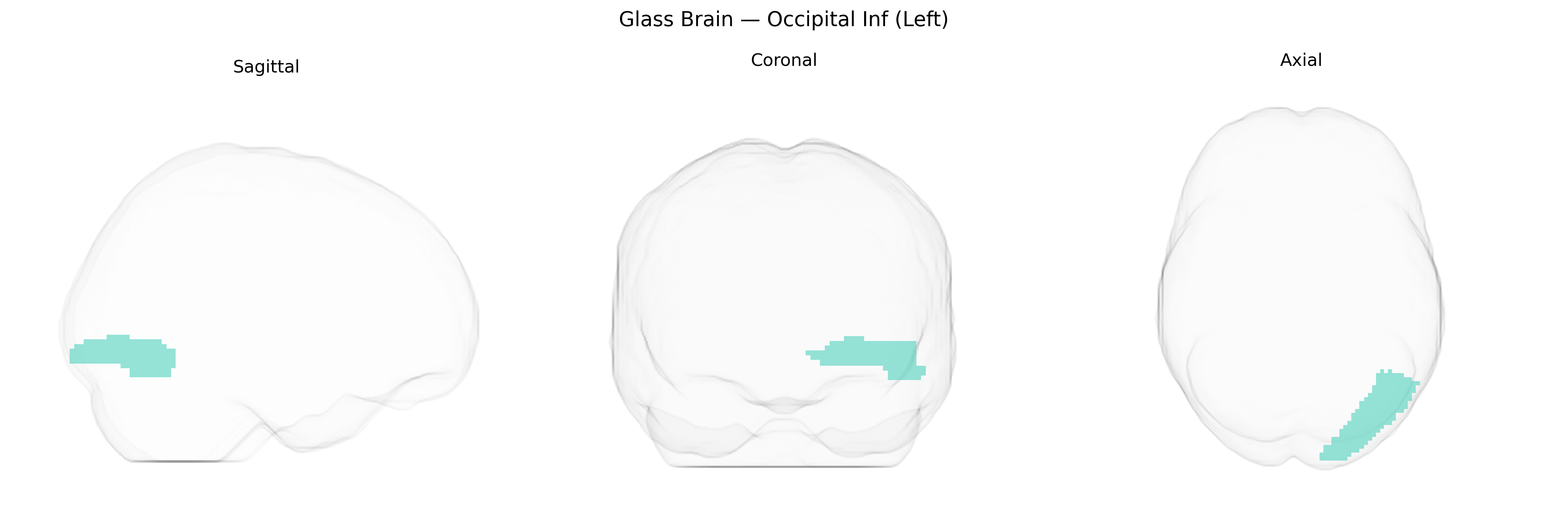Triplanar Ghost Brain