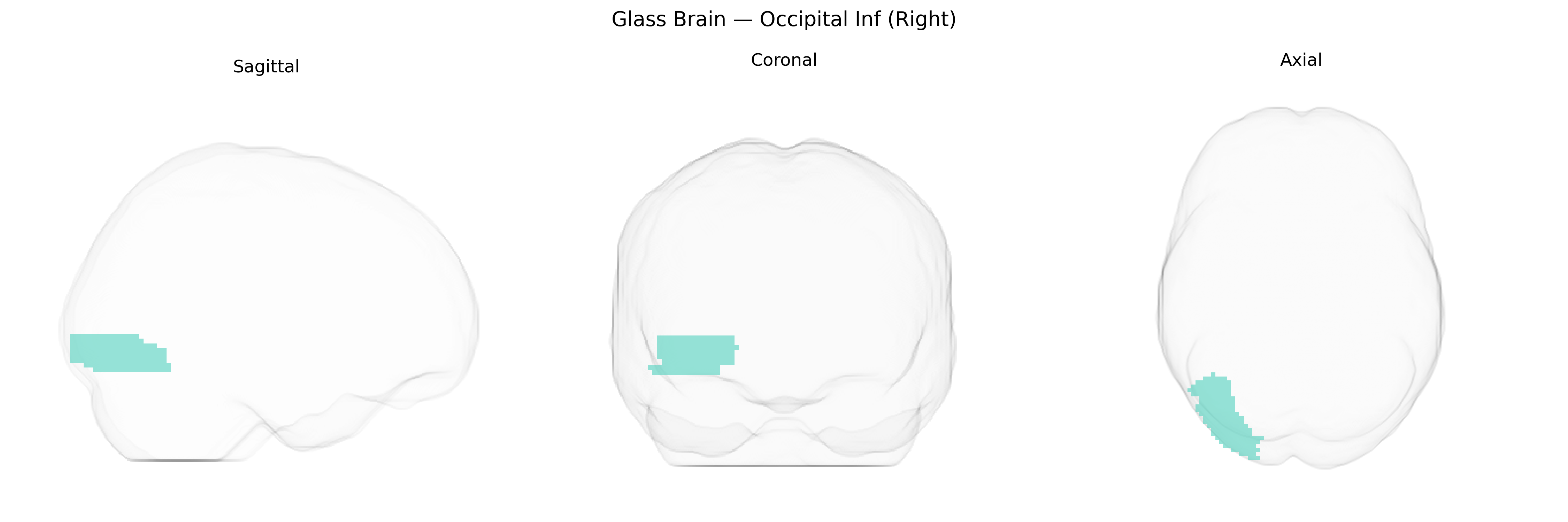 Triplanar Ghost Brain