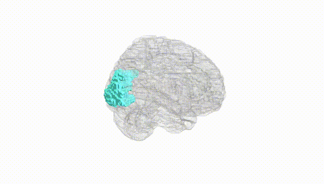 Full Brain White