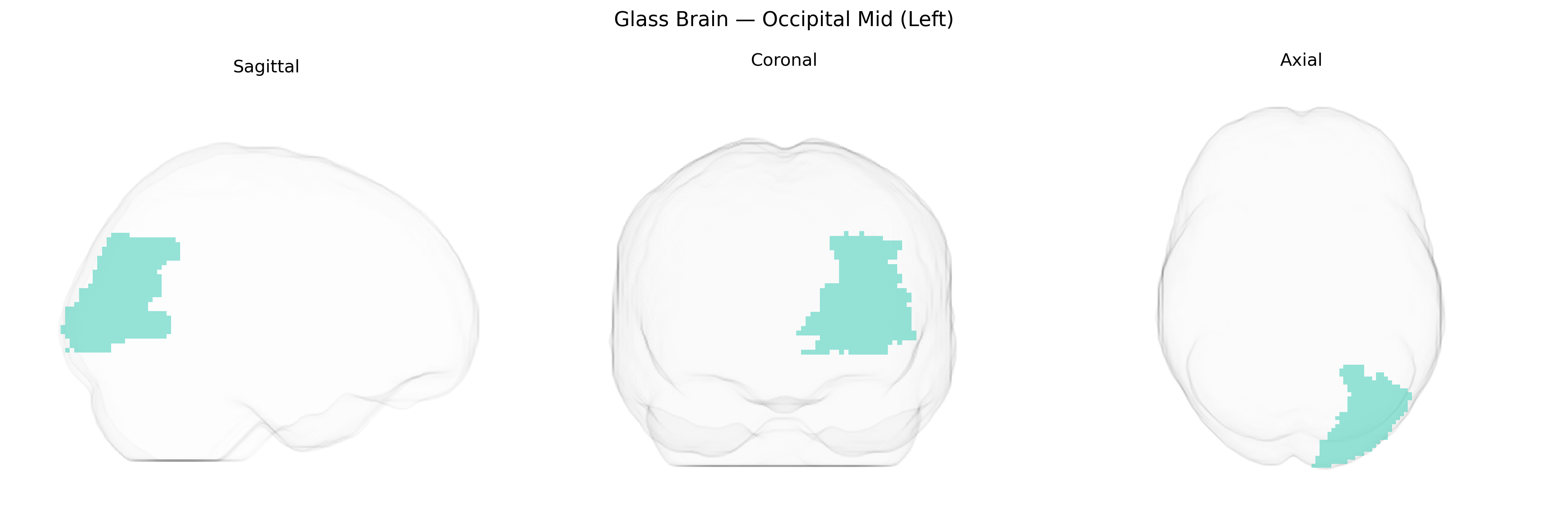 Triplanar Ghost Brain