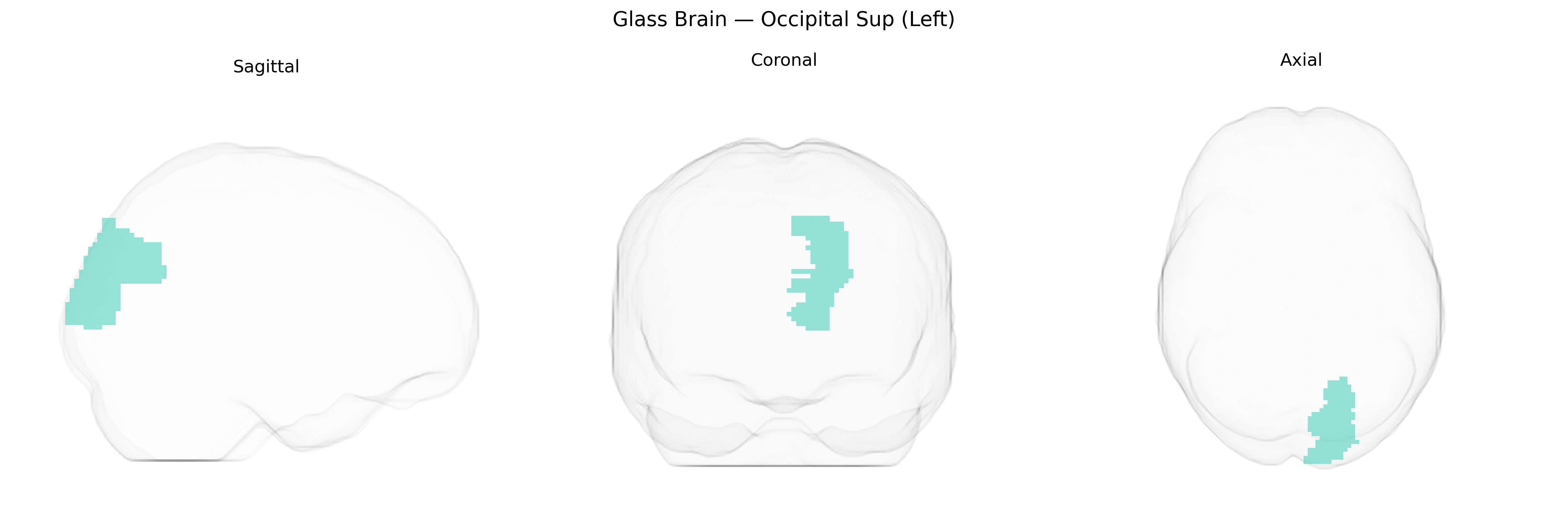 Triplanar Ghost Brain