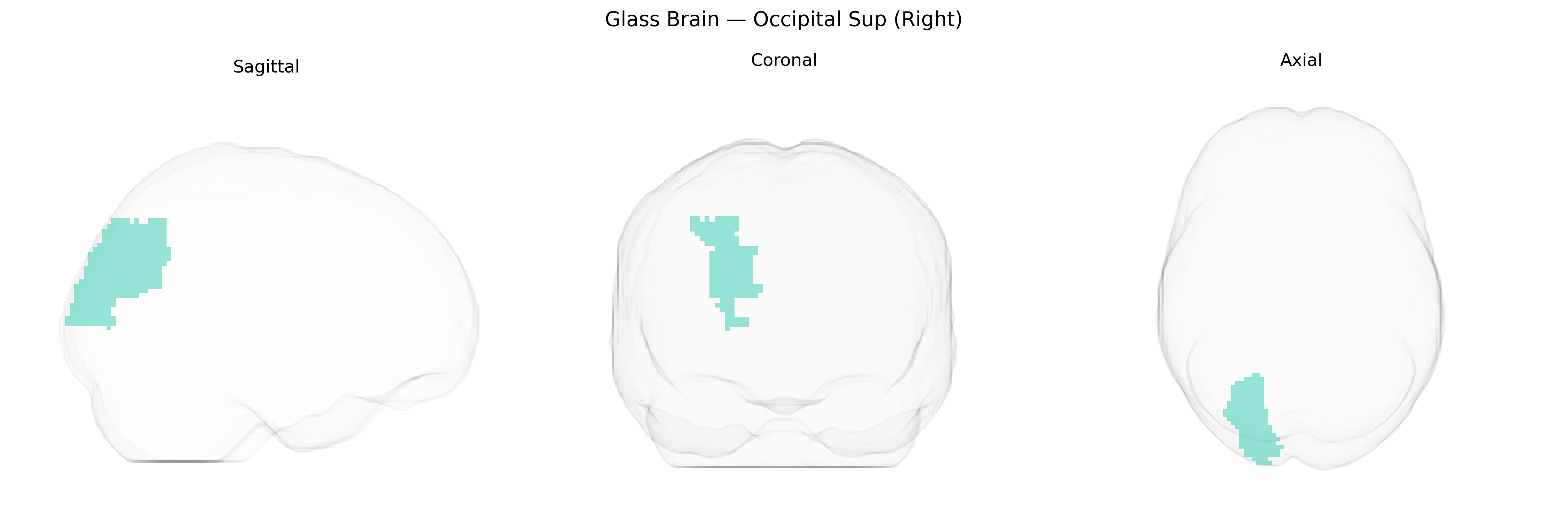 Triplanar Ghost Brain