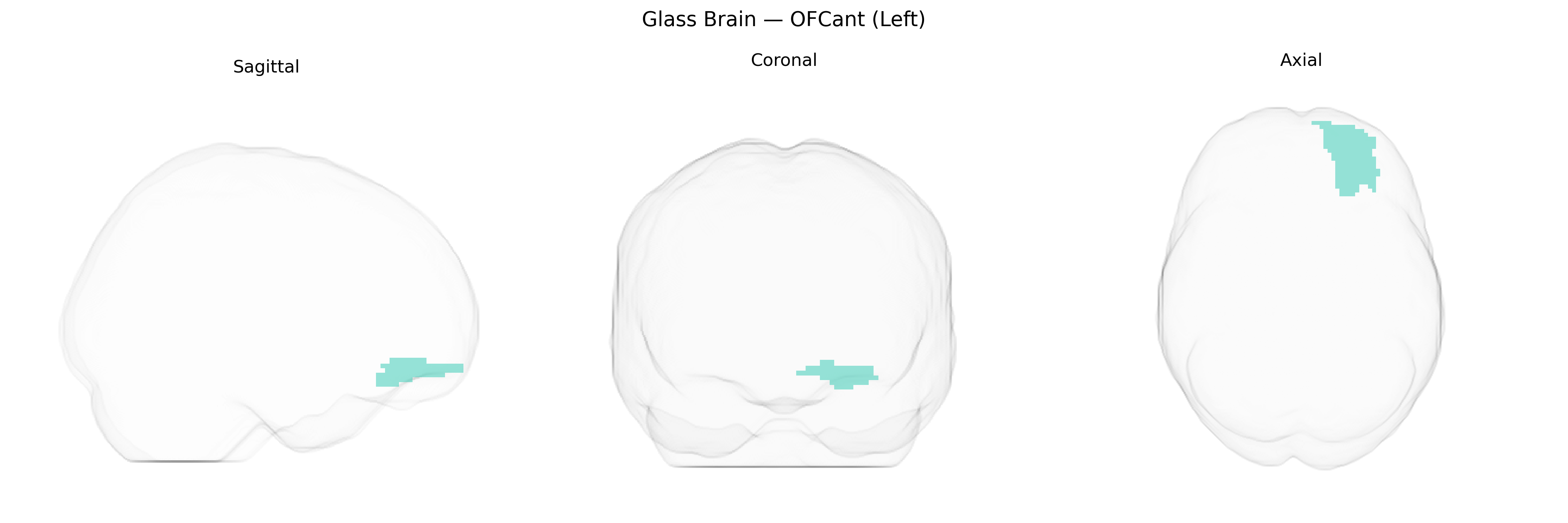 Triplanar Ghost Brain