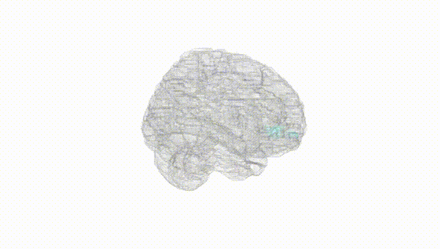 Full Brain White